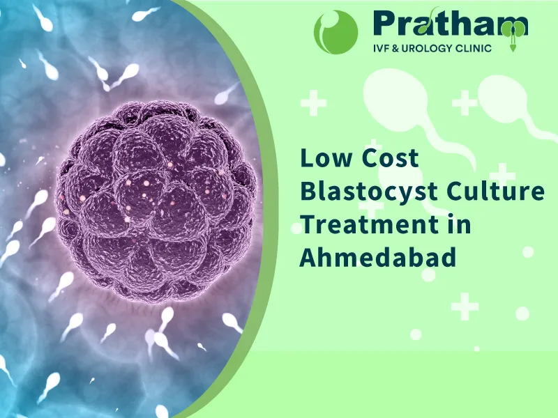 Low Cost Blastocyst Culture Treatment in Ahmedabad