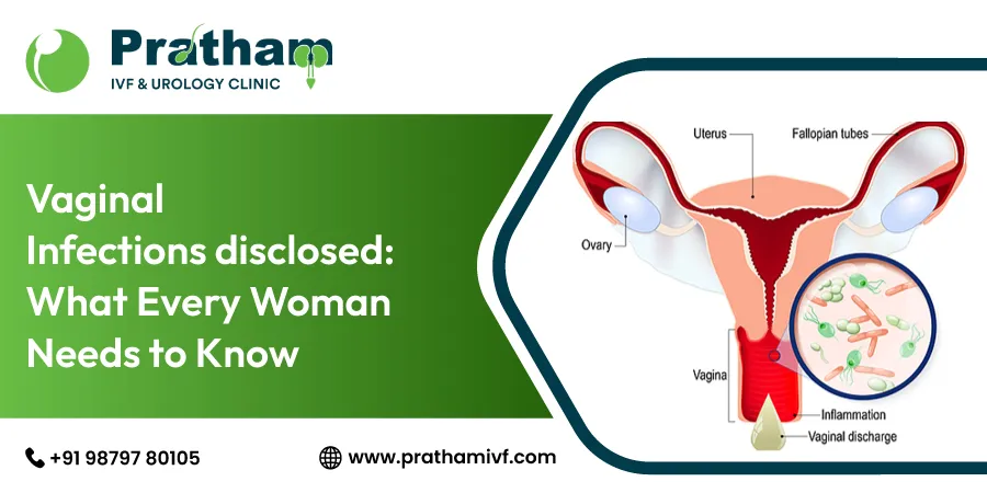 Vaginal Infections Disclosed: What Every Woman Needs to Know
