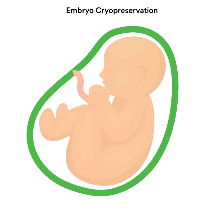 Cryopreservation