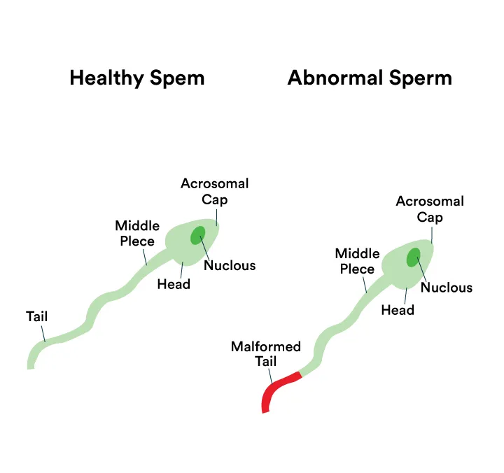 Low Sperm Count Treatment in Ahmedabad – Pratham IVF Center